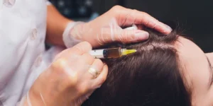 How Much Does PRP Hair Treatment Cost In Jeddah?