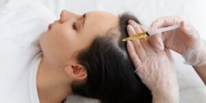 Is PRP Hair Treatment Permanent Solution For Hair Loss?