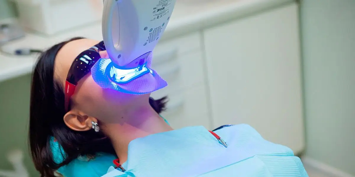 How Much Does Laser Teeth Whitening Cost In Jeddah?